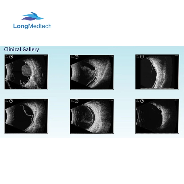 12.1 Inch Touch Screen Medical Ophthalmology Equipment Ophthalimic Ab Ultrasound Scanner